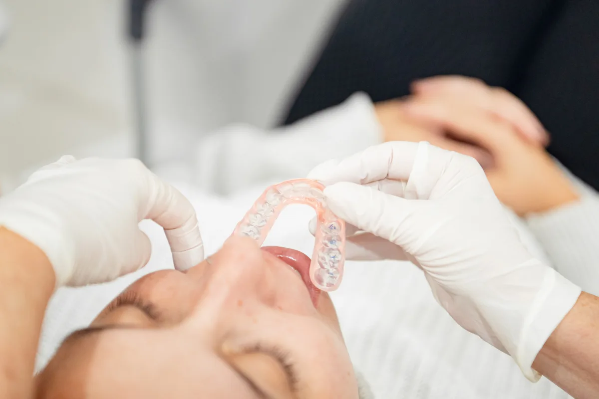 Clear dental aligner being fitted over teeth