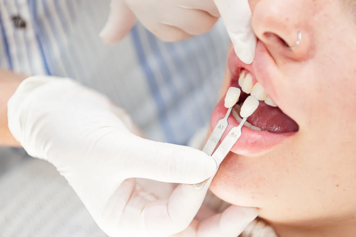 Shade and proportion at Ivy Dental