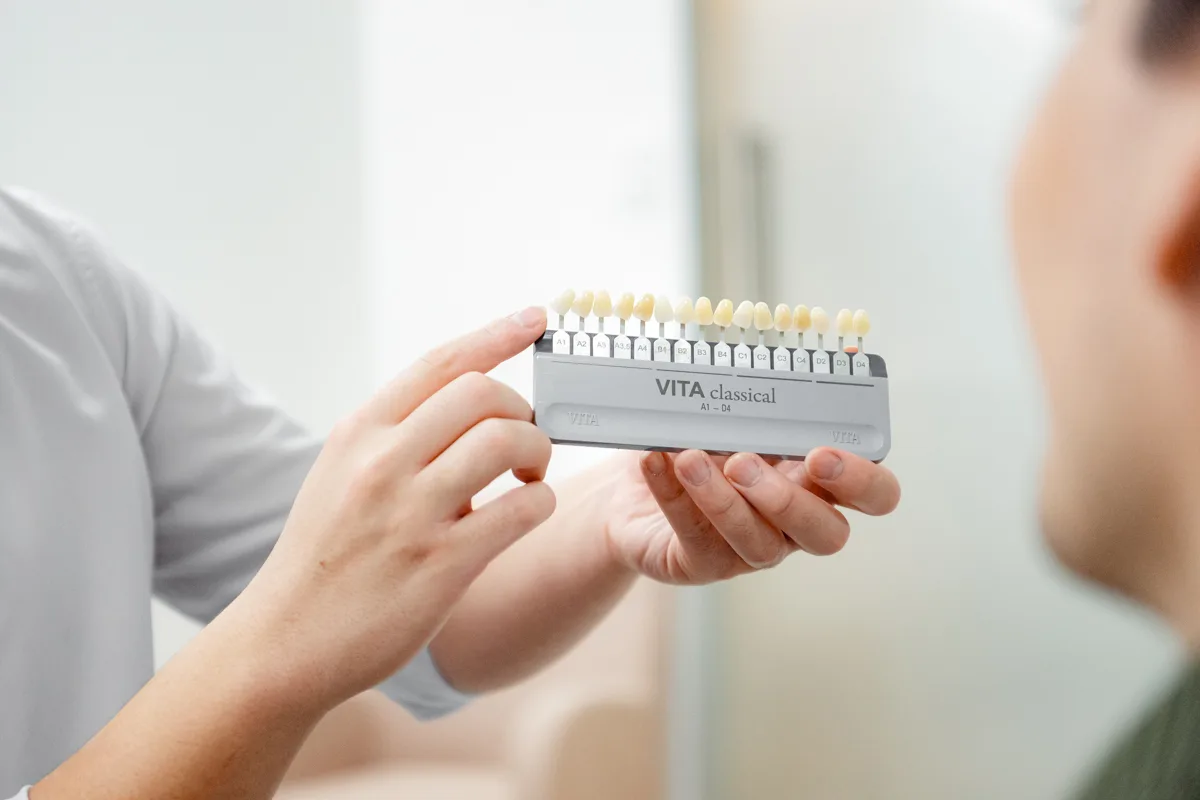 Dentist comparing tooth shades with a shade guide