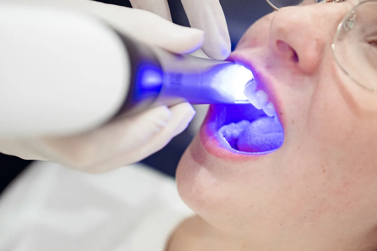 Clinician supervising professional in-chair teeth whitening